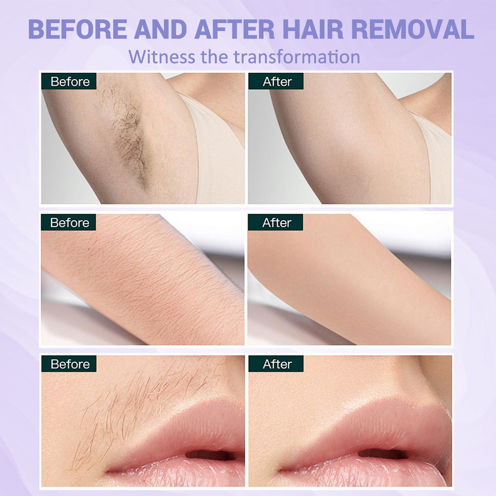 LYQC garantía de 180 días con devolución o reemplazo.