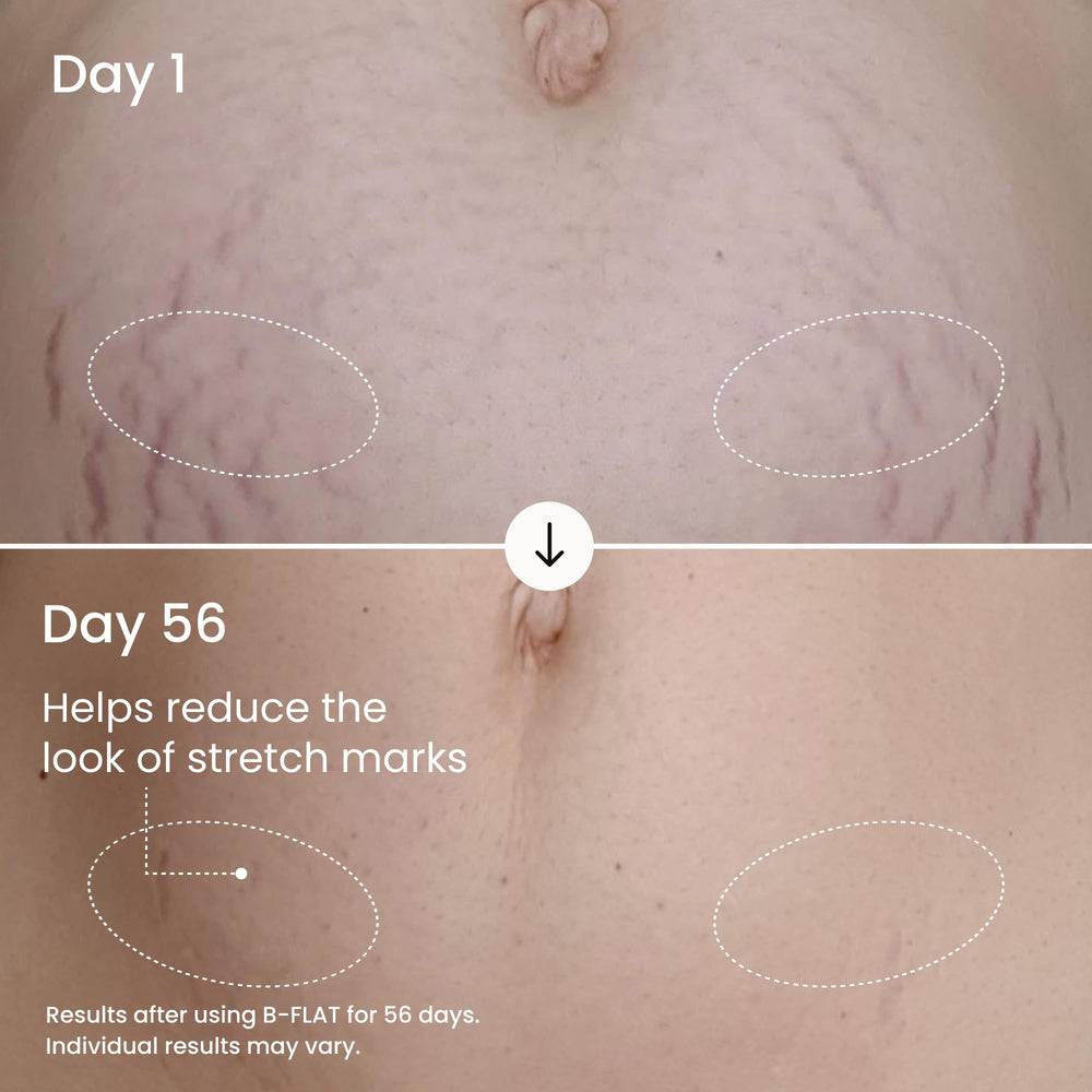 MAËLYS B-FLAT aplicación en giros para cuidado diario de la barriga.