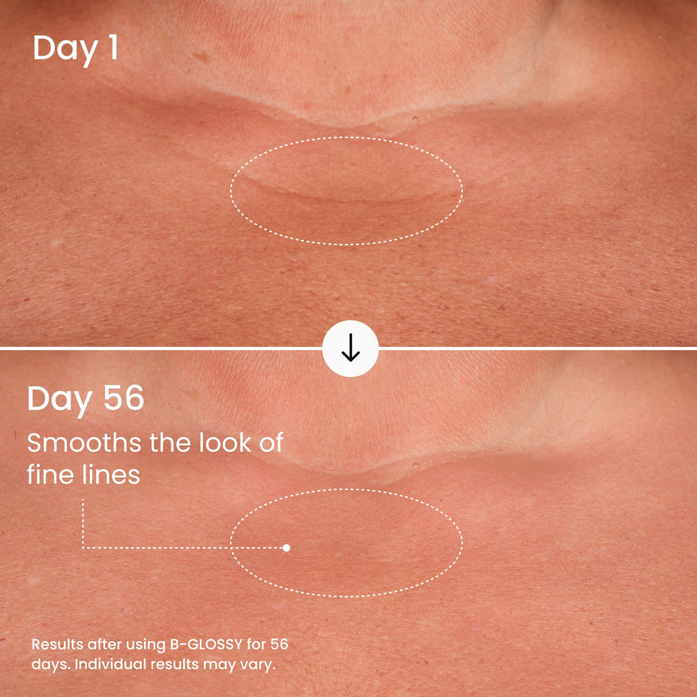 Texture du torse et des bras plus lisses grâce au sérum Maelys B-GLOSSY.