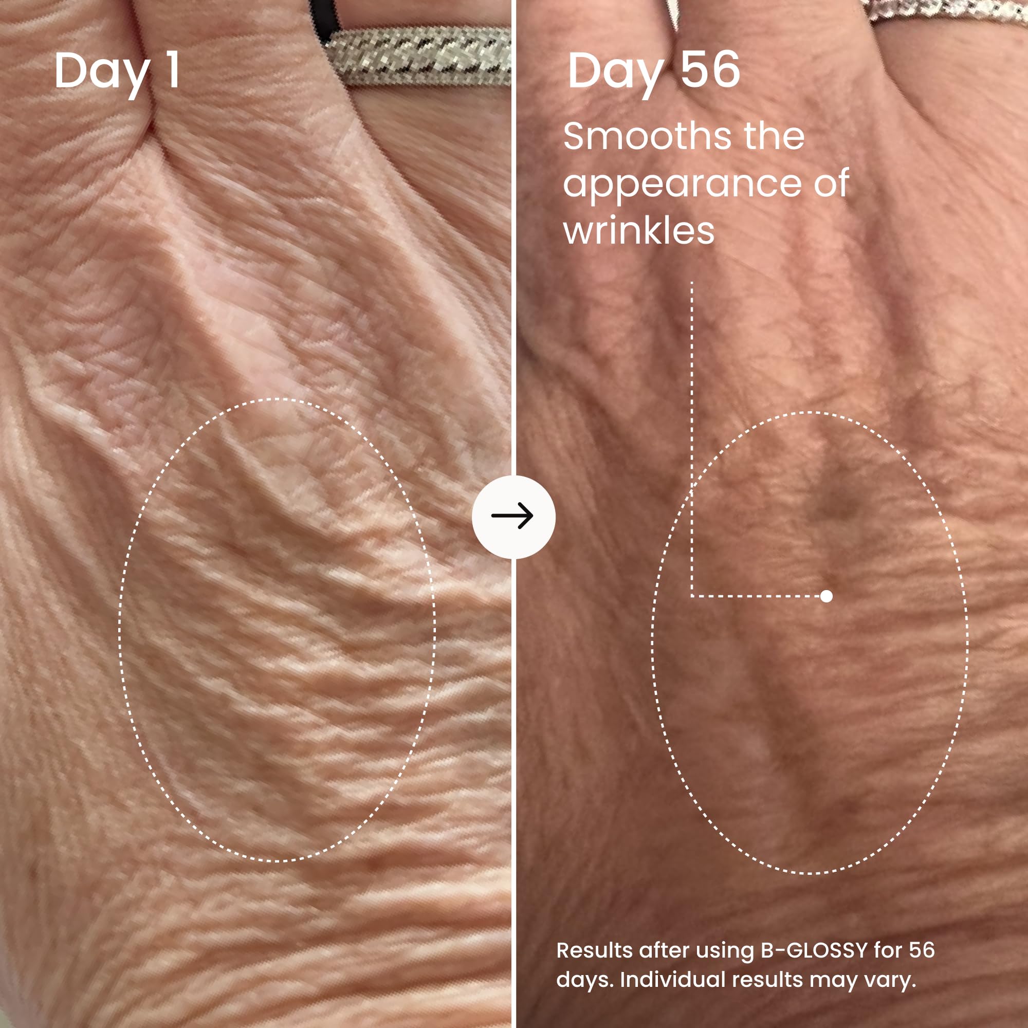 Maelys B-GLOSSY sur peau crepee des bras: effet lissant et uniformisant.