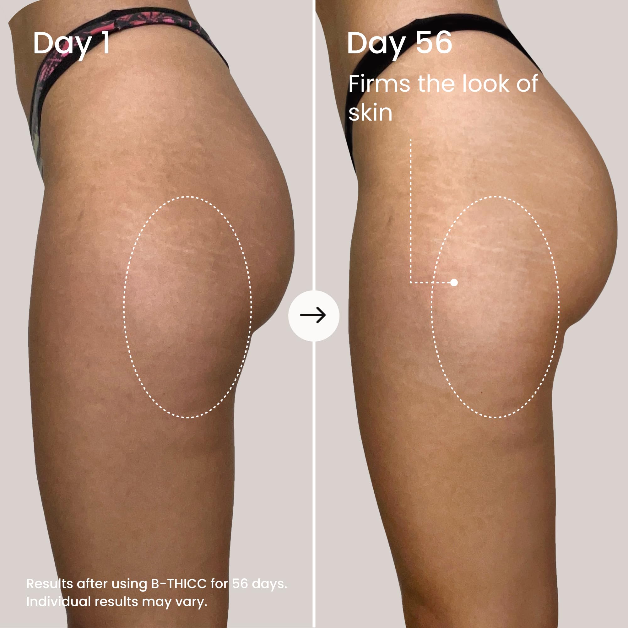 MAËLYS B-THICC: firmeza de piel en glúteos para una apariencia definida.