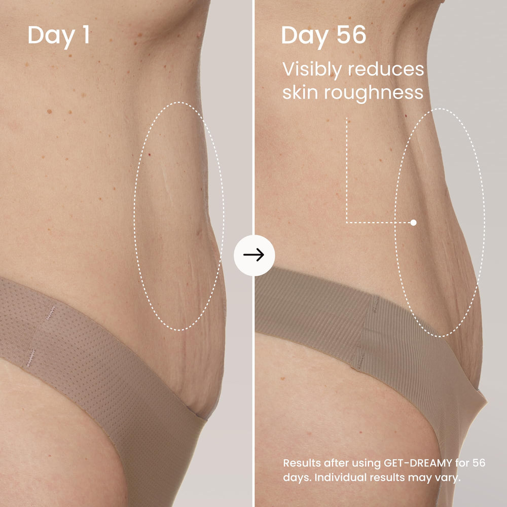 Geste de massage sur la cuisse avec Maëlys Get-Dreamy durant l’application.