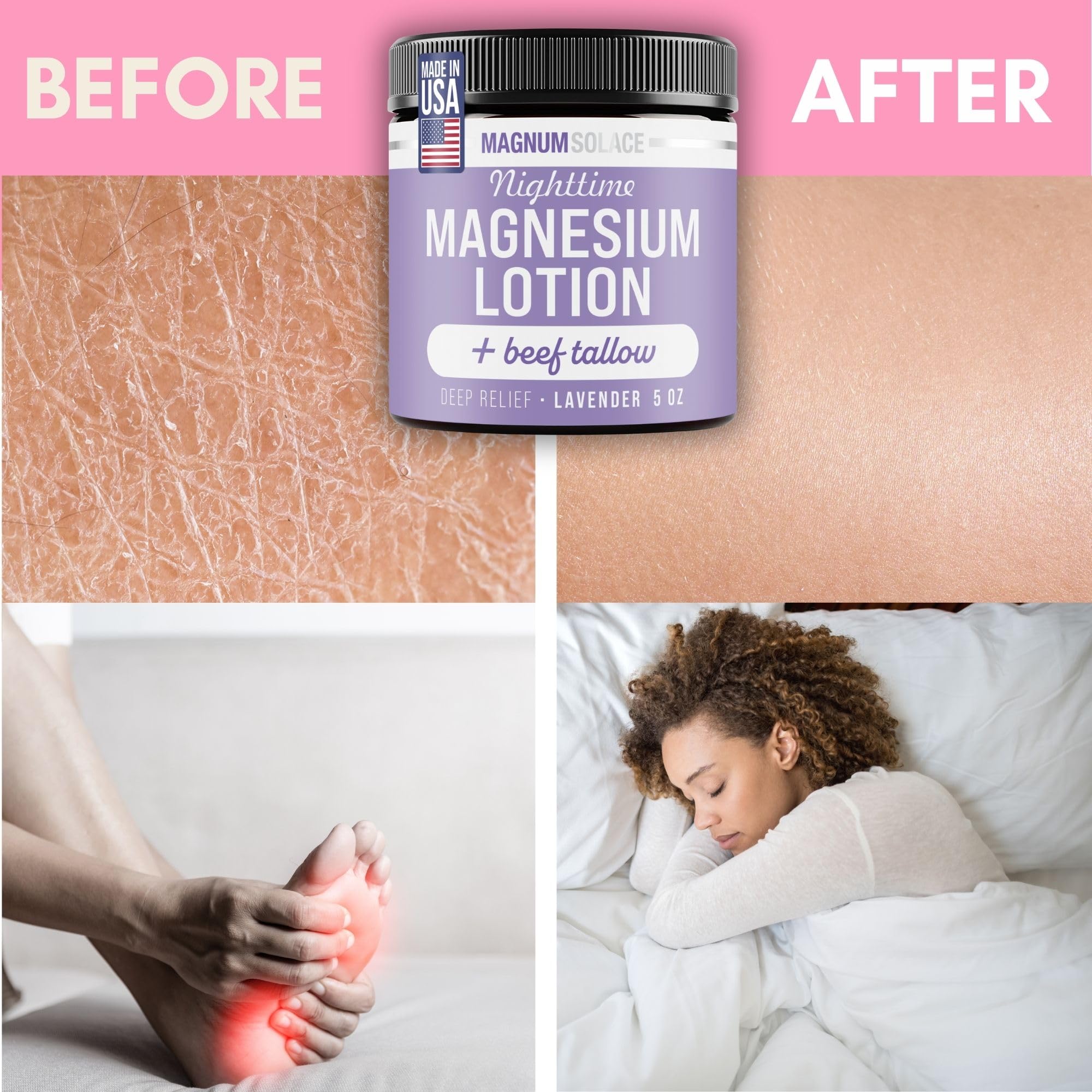 Magnum Solace masaje Arnica para comodidad de músculos cansados.