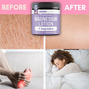 Magnum Solace masaje Arnica para comodidad de músculos cansados.