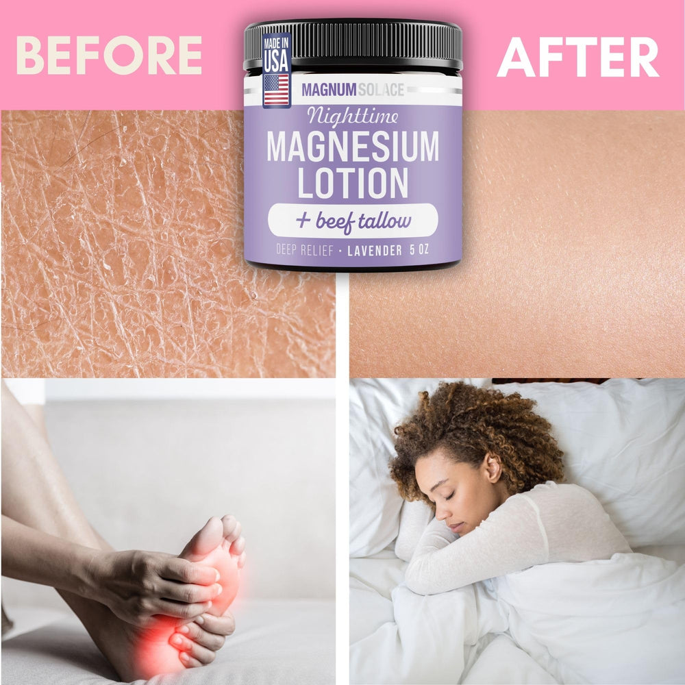 Magnum Solace masaje Arnica para comodidad de músculos cansados.