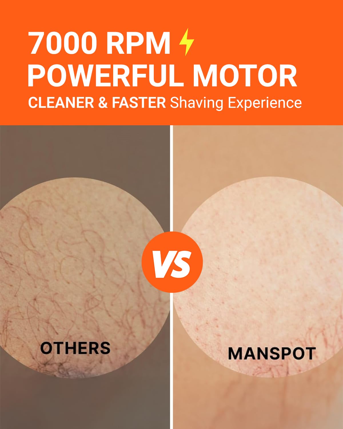 MANSPOT Manscape bateria-larga-duracion rinde hasta 20 sesiones.