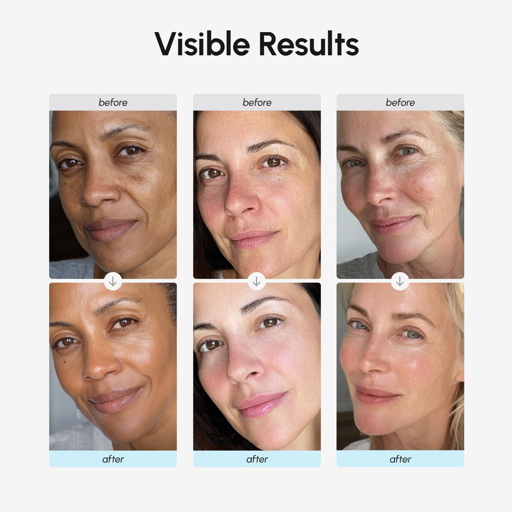 MAREE Crema facial ingredientes retinol hialuronico: fórmula destacada.