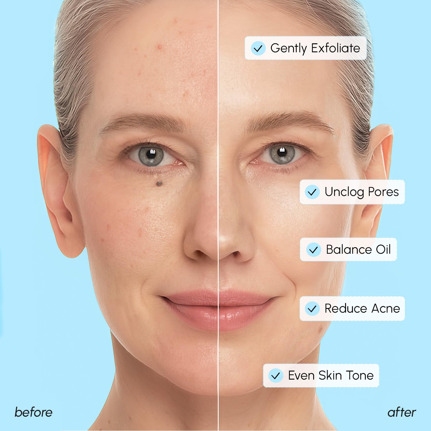 MAREE Pads exfoliación química suave para una piel más lisa.