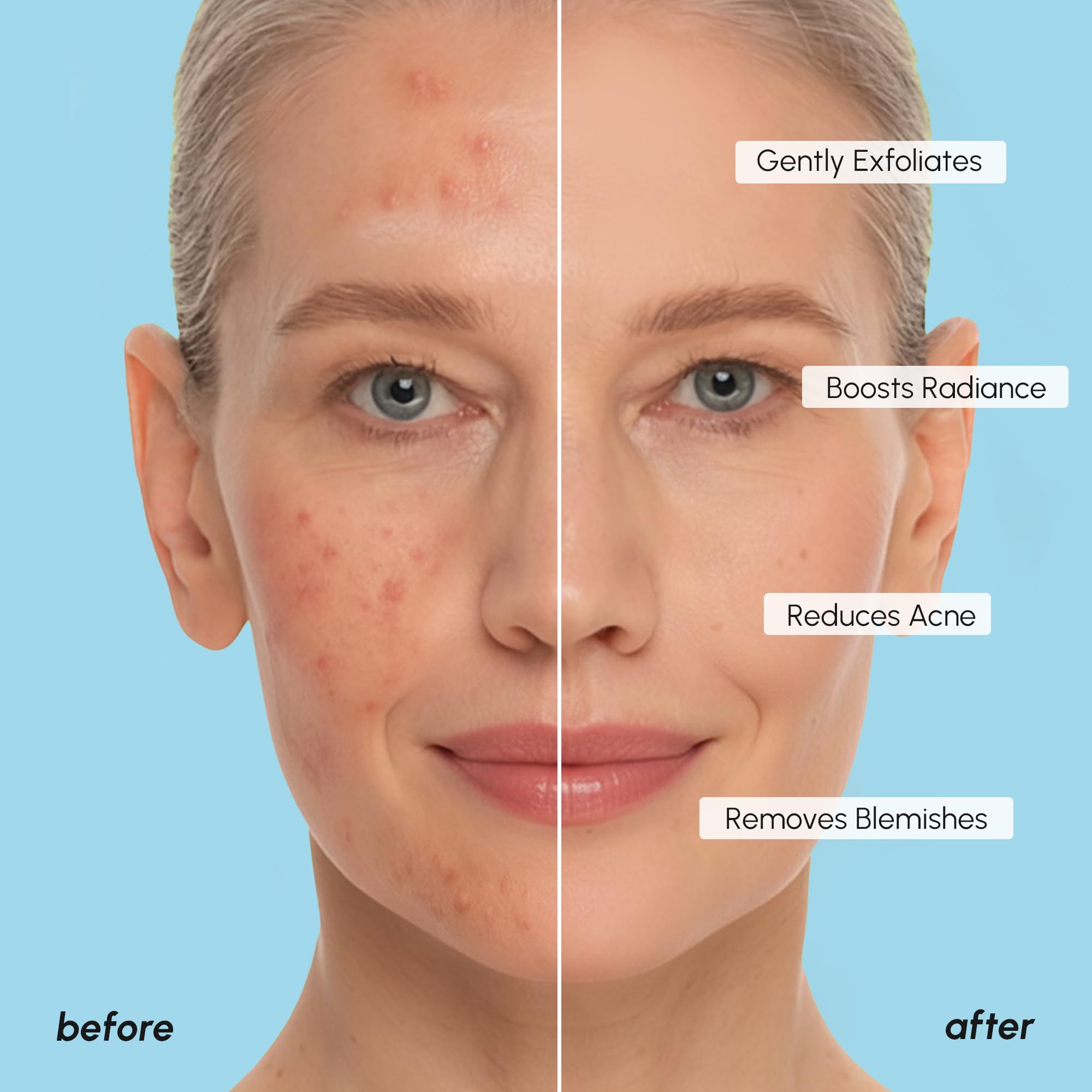 MAREE disco para refinar poros y textura de piel