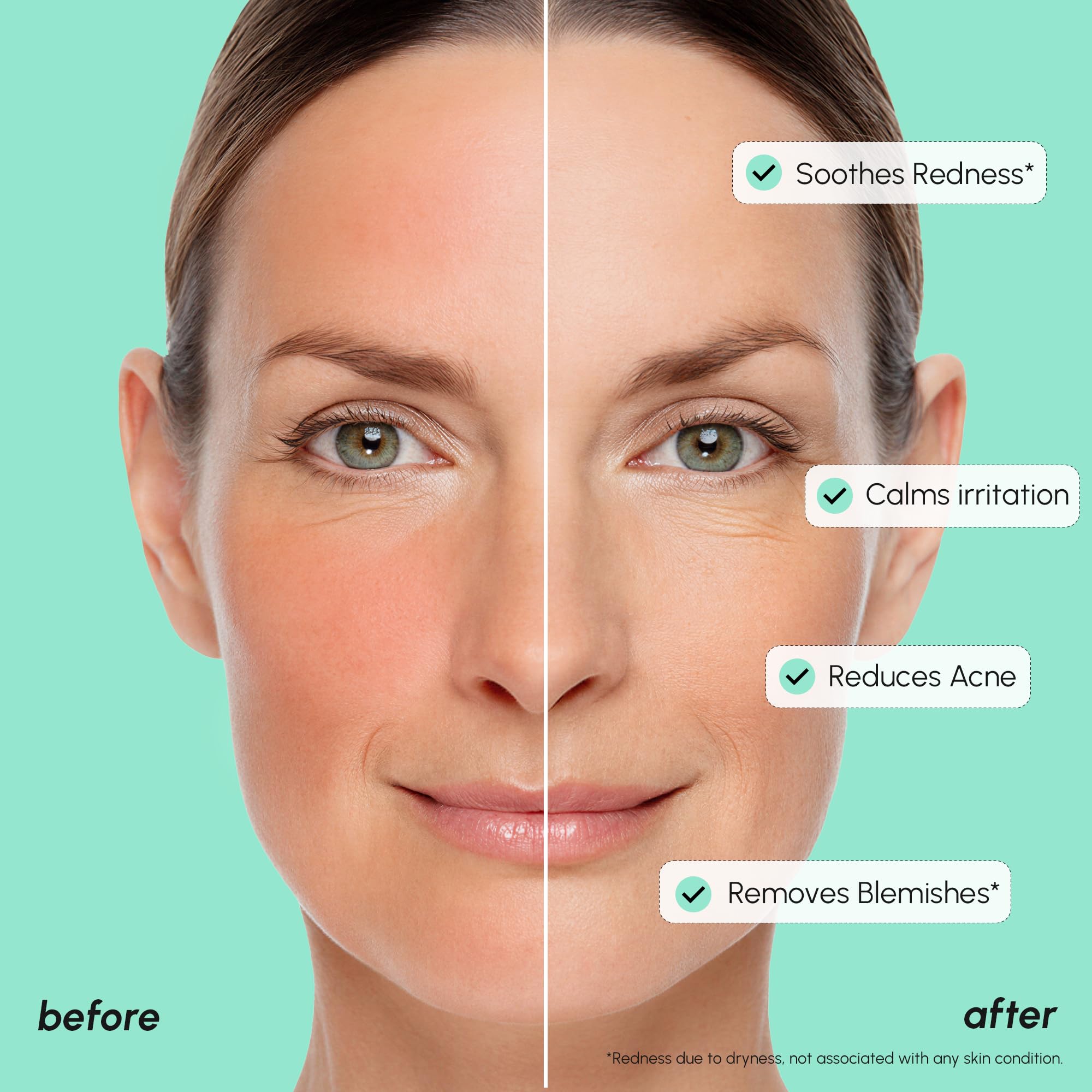 MAREE 10% con gota dosificadora para aplicación precisa.