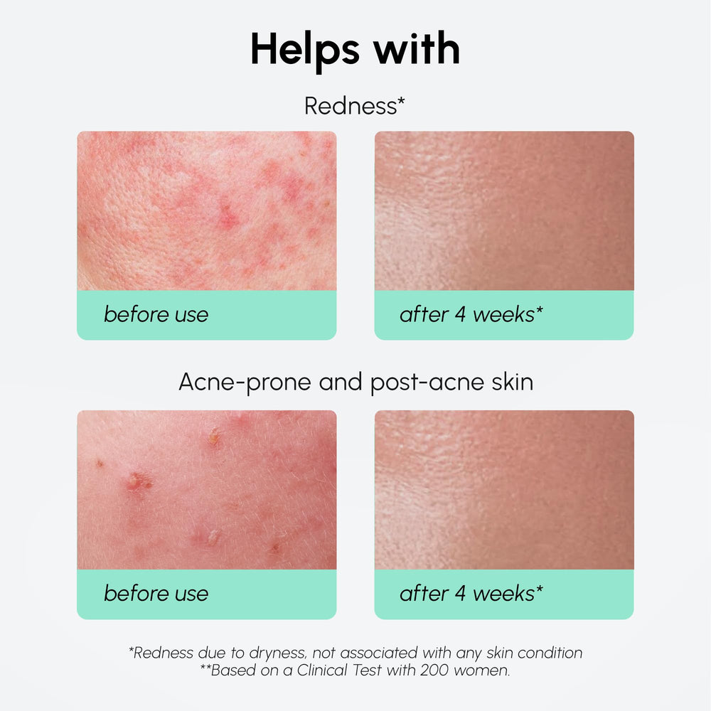 MAREE 10% suero ligero que se absorbe rápidamente.