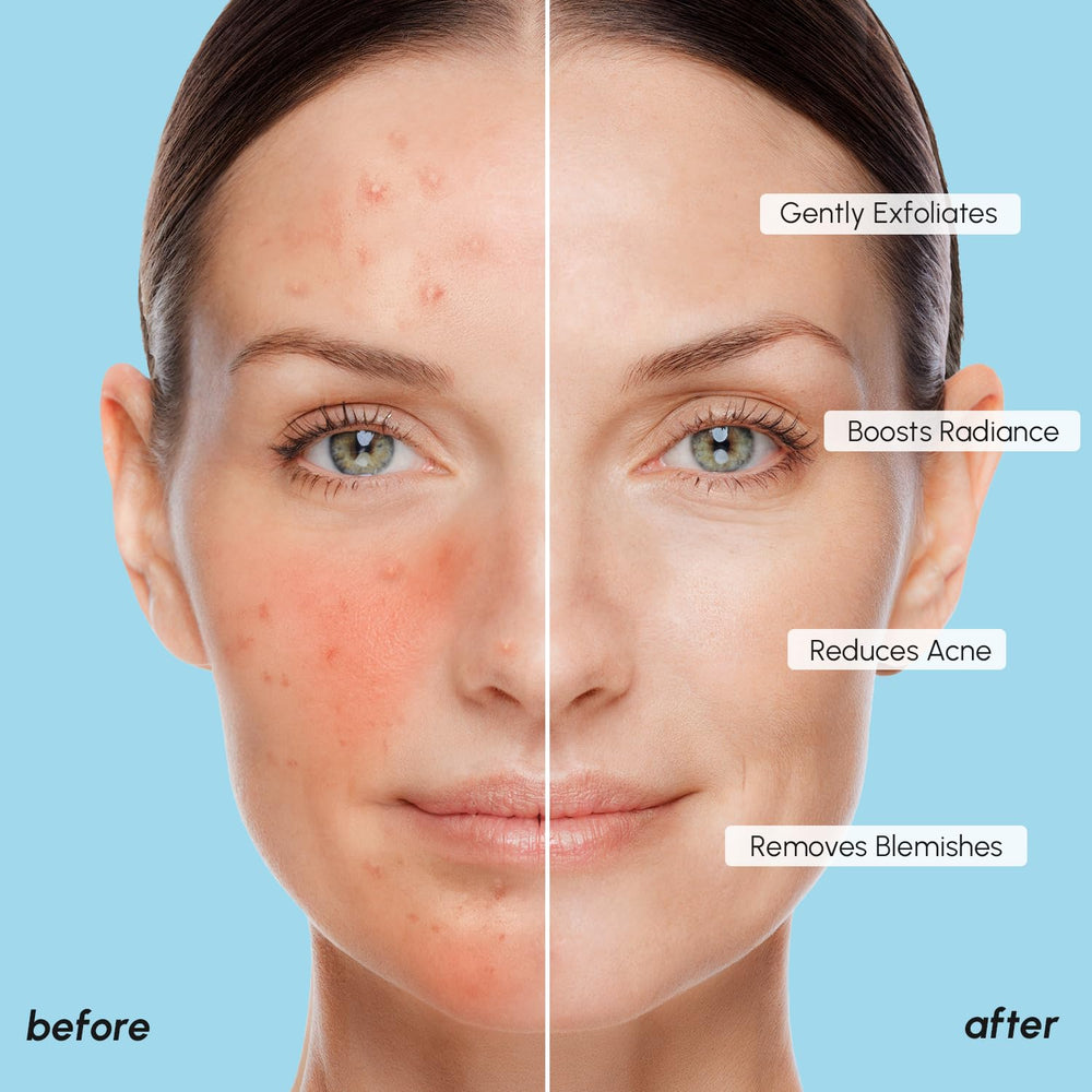 MAREE textura suave de disco exfoliante listo para aplicar