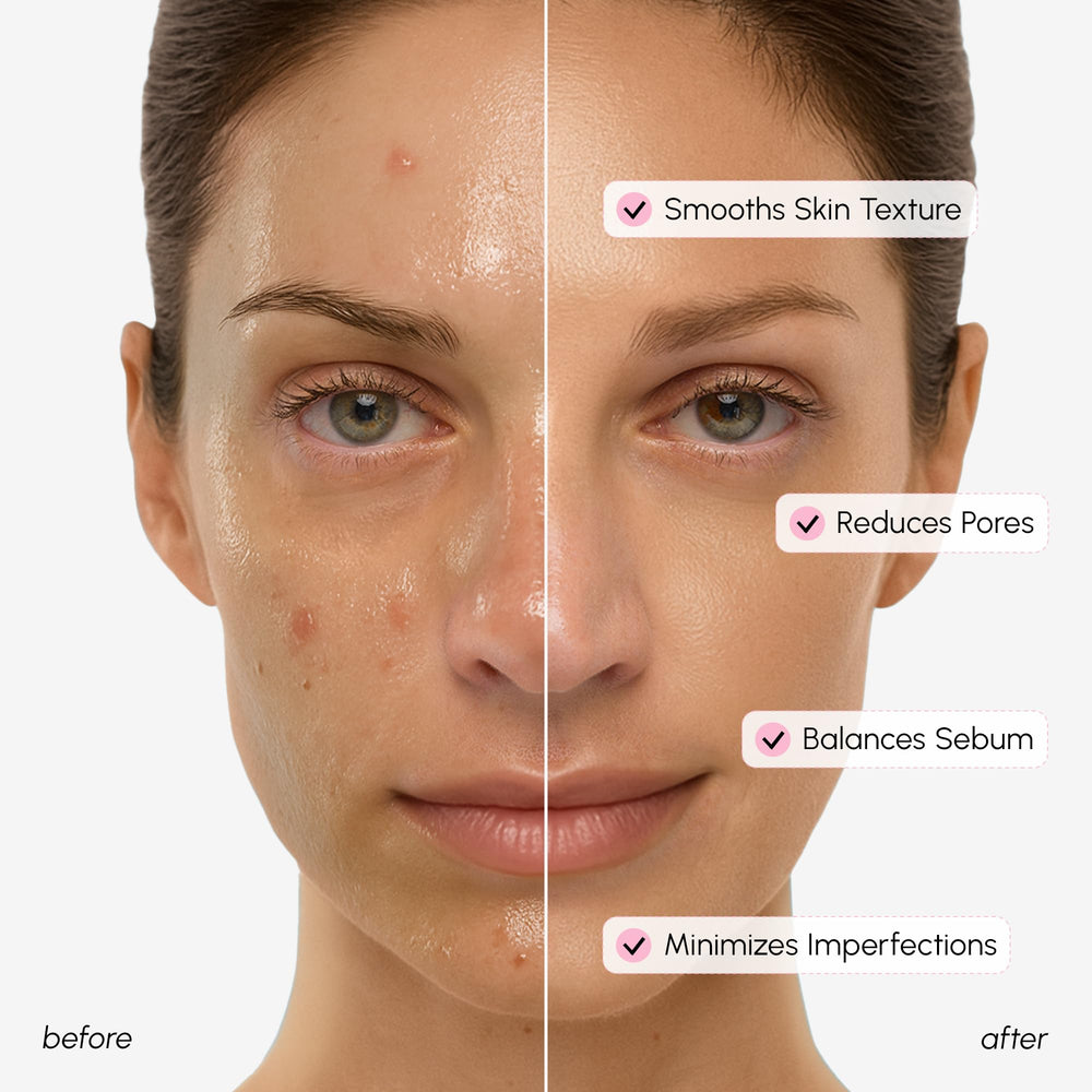 MAREE Tonique niacinamide - hydratation legere et teint uniforme