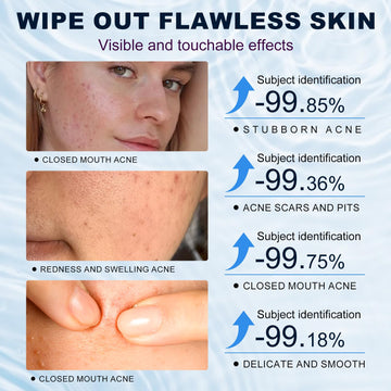 marianp crema ácido azelaico 10% textura suave cuida la barrera cutánea