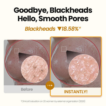 MAXCLINIC PuriteaToc: ingredientes herbales que apoyan la hidratación durante la limpieza