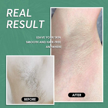 Maxpearl perlas de cera dura para espalda, cobertura amplia y retirada eficiente.