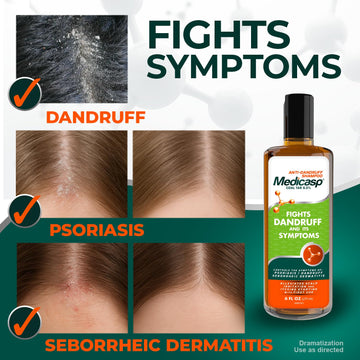 Medicasp Coal Tar Shampoo application scene shows scalp massage for soothing relief.