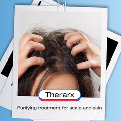 TheraRx espuma cremosa en la mano para aplicar en cabello y piel.
