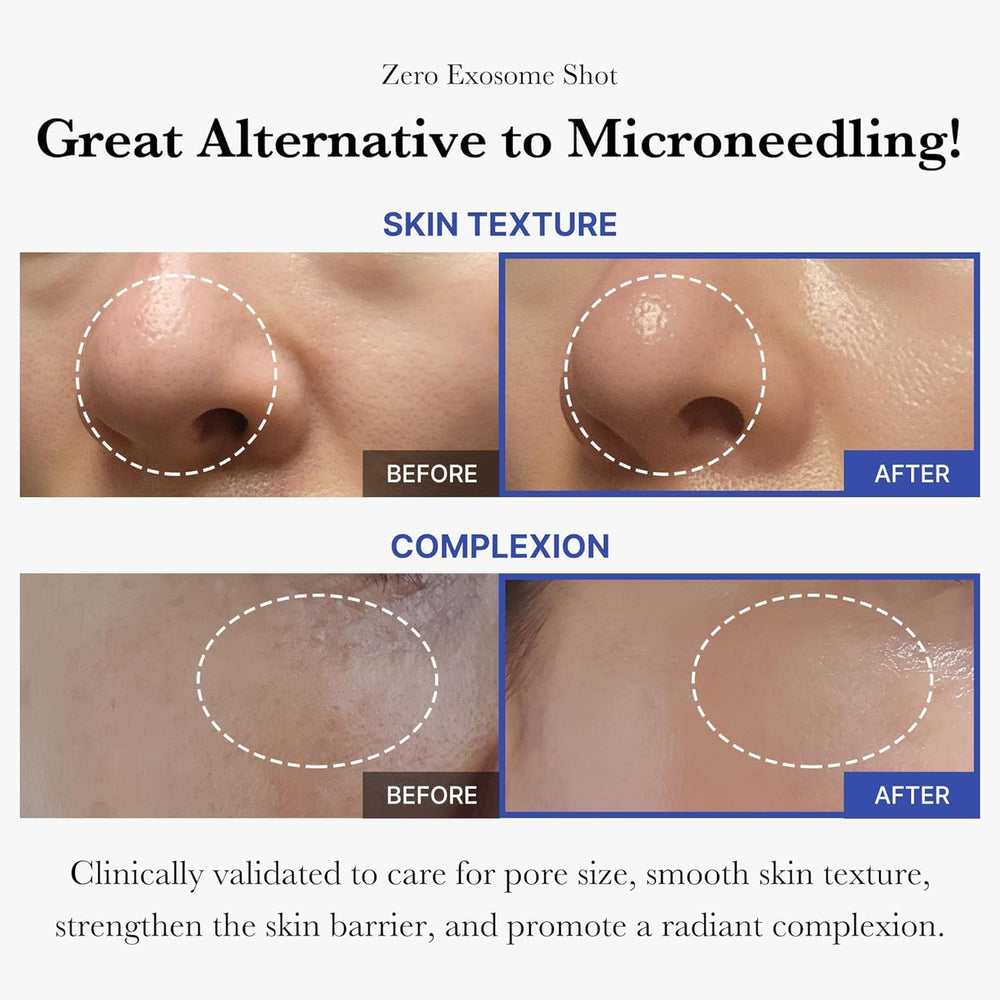 Medicube Exosome Shot Zero – application sur les pores avec précision et douceur.