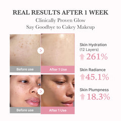 Medicube PDRN Pink Collagen Bubble Serum, hidrata y fortalece la barrera con ácido hialurónico y ceramidas.