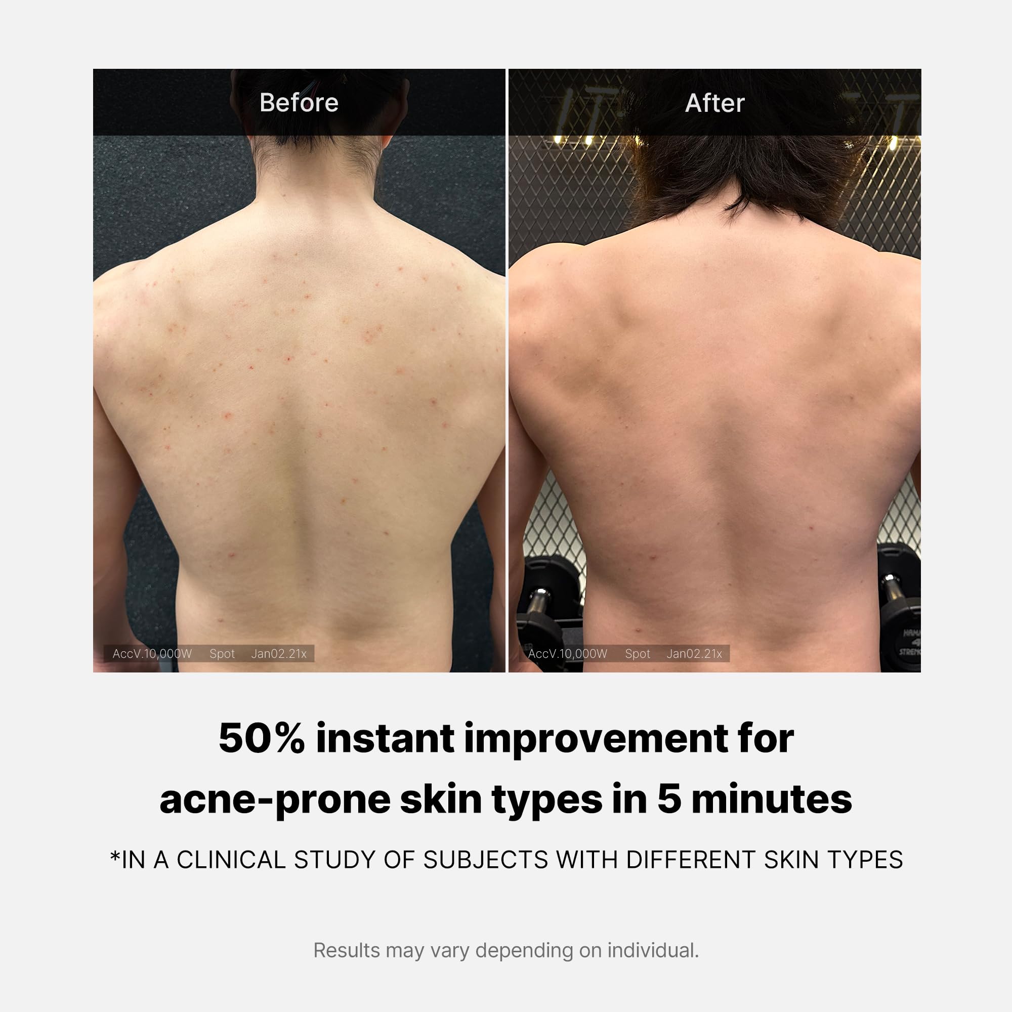 Ingrédients: acide salicylique, niacinamide et acide hyaluronique.