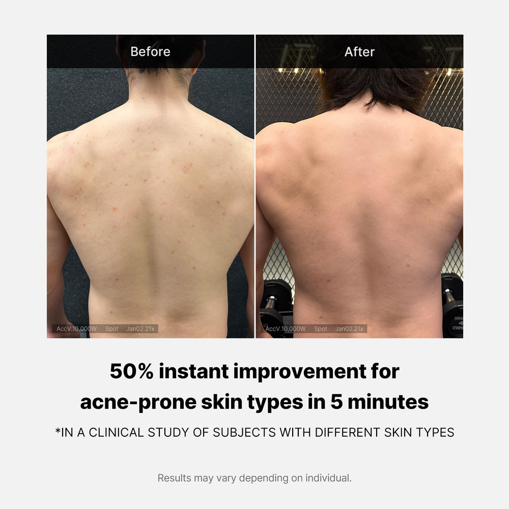 Ingrédients: acide salicylique, niacinamide et acide hyaluronique.
