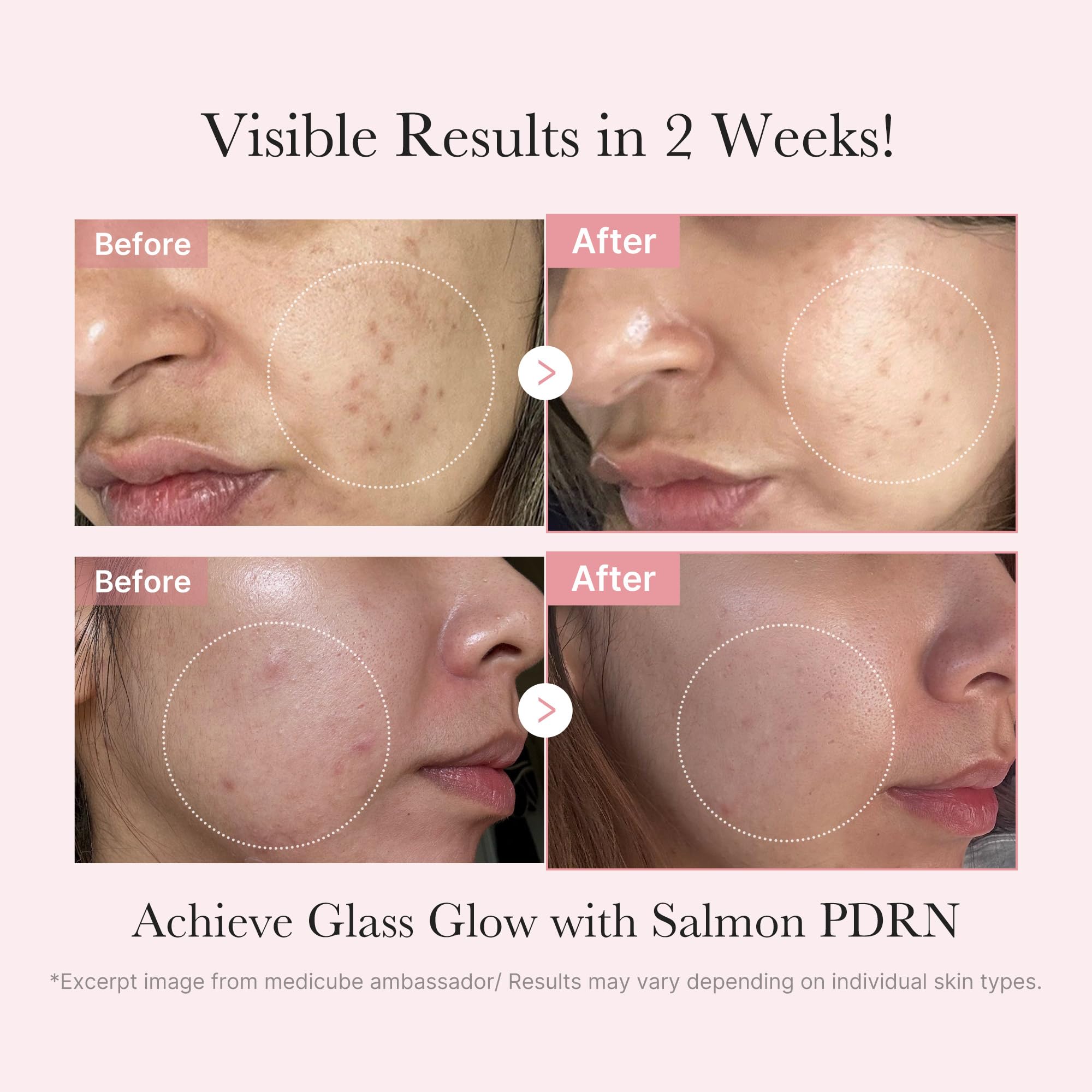 Medicube Salmon DNA Ampolla mini favorece renovación suave de la piel.