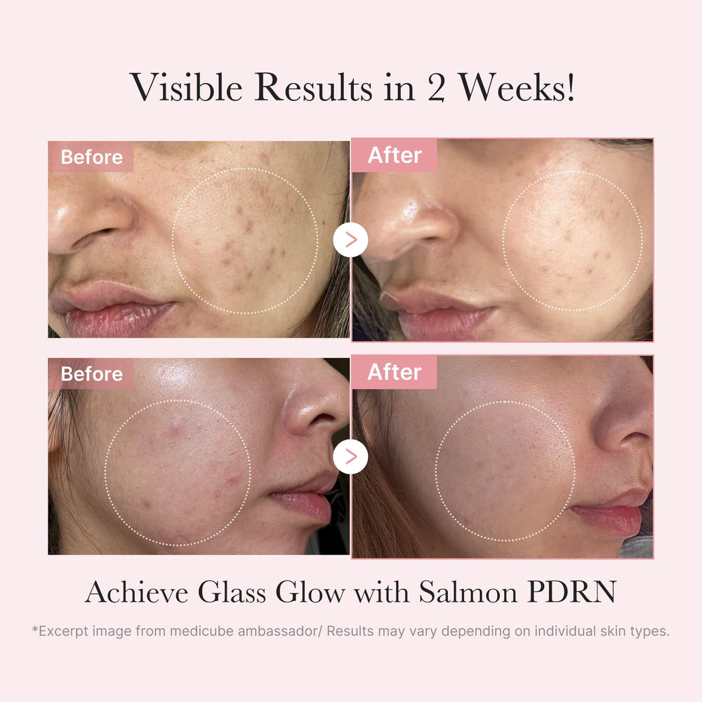 Medicube Salmon DNA Ampolla mini favorece renovación suave de la piel.