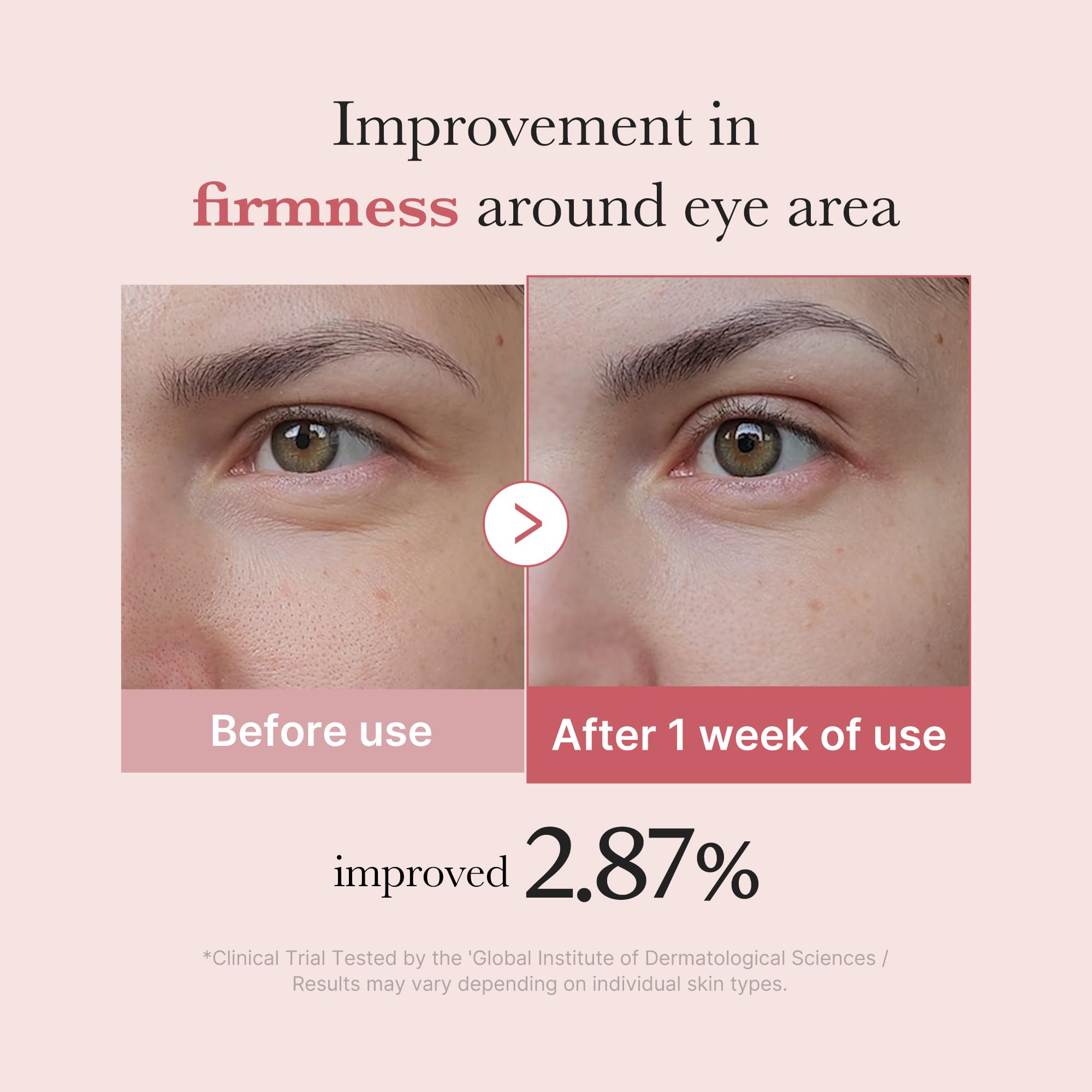 Medicube Eye Serum con PDRN: ADN de salmón mejora la textura del contorno.
