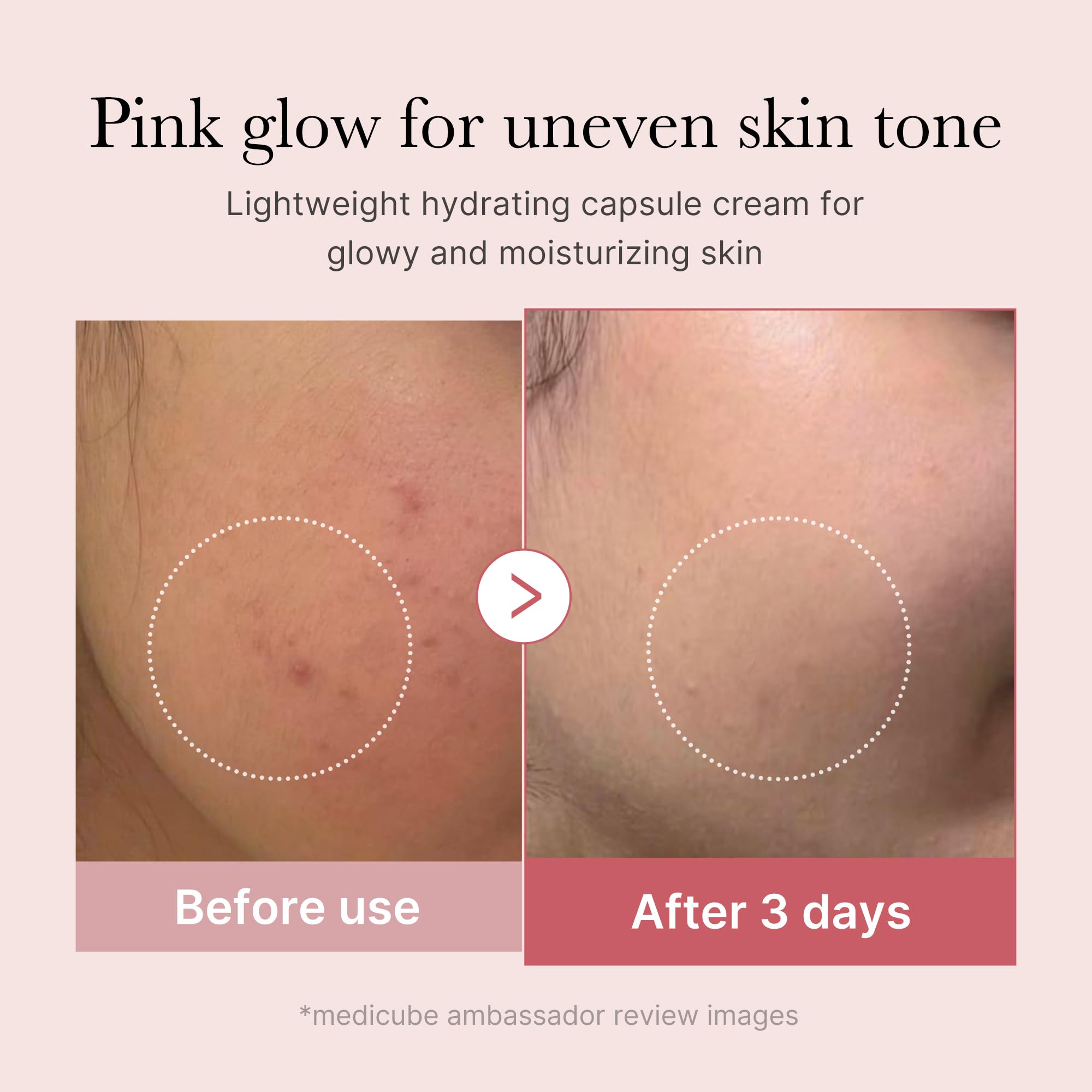 Medicube Teint Éclat Transparent — peau lumineuse après absorption.
