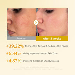 Medicube Toner ingredientes clave: Kojic, Turmeric y Niacinamide para piel luminosa.