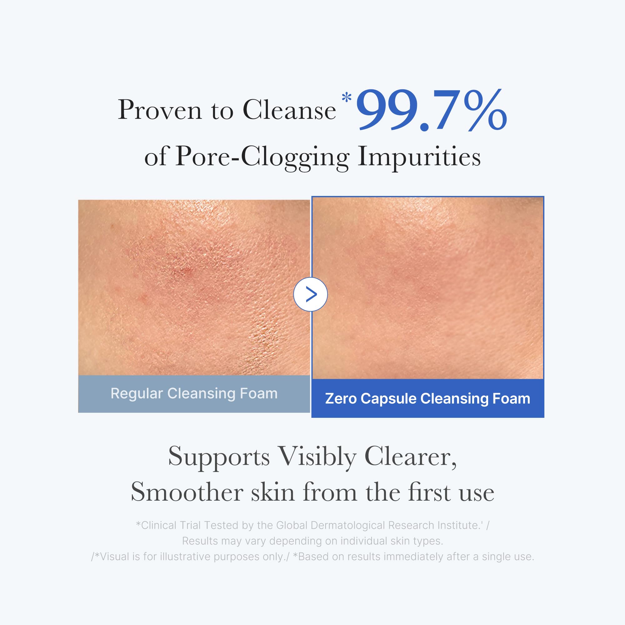 Medicube Zero Pore: exfoliación suave con partículas de sílice para eliminar impurezas sin irritación.