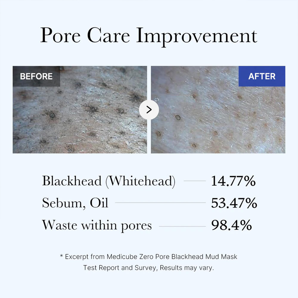 Sensación refrescante durante el uso de Medicube Zero Pore.