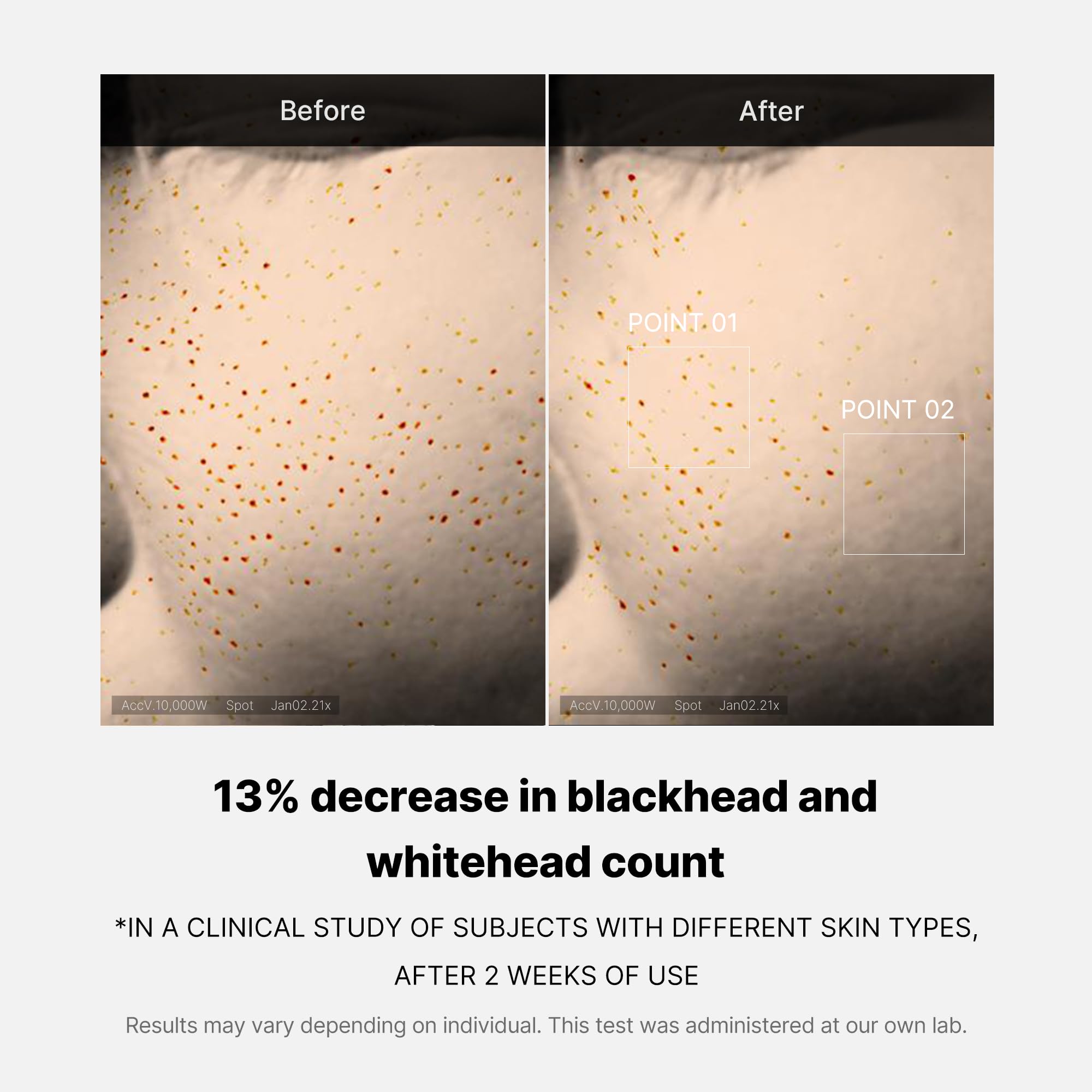 Rutina nocturna con Medicube Zero Pore Serum para control de sebo.
