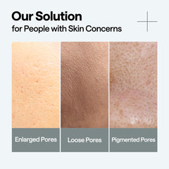 Mediheal Madecassoside pore-tightening close-up emphasizes smoother texture.