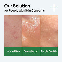 Aplicación rápida con el suero calmante tras la limpieza facial.