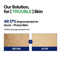 Gaze non irritante Mediheal Teatree Trouble Pad, texture douce pour peaux sensibles.