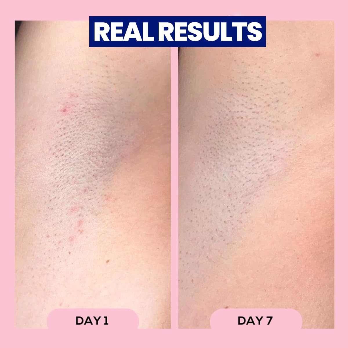 Megababe Après Shave para bikini y axilas, cuidado específico para zonas sensibles