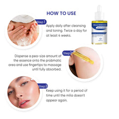 MEOLY Milia Remover, textura ligera que facilita la absorción del hidratante.