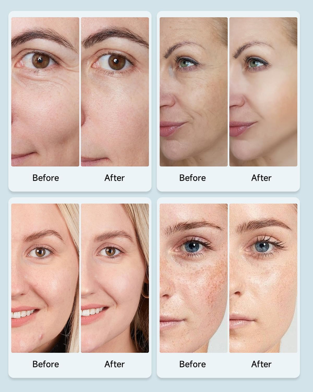 MIBIITTY mascarilla iluminada, correa ajustable para ajuste cómodo.