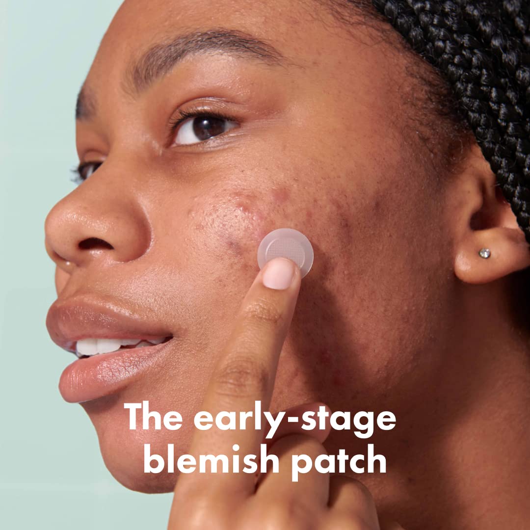 Mighty Patch Micropoint Grande: aplicación en la piel para imperfecciones tempranas