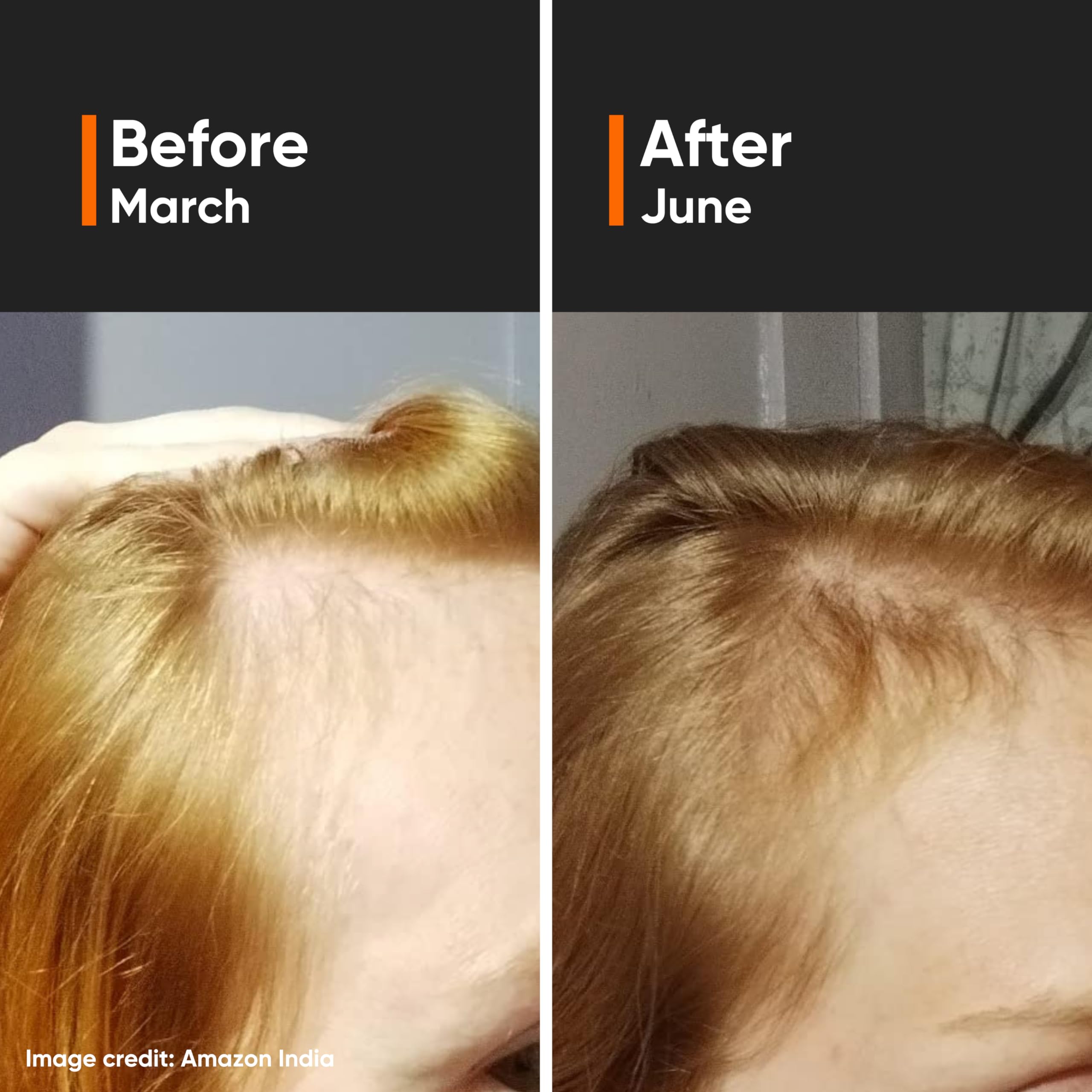 Aplicación suave del serum Minimalist para masajes en cuero cabelludo.