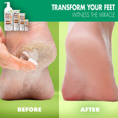 Miracle of Aloe Foot Repair Cream targets heel areas to soften and smooth cracked skin
