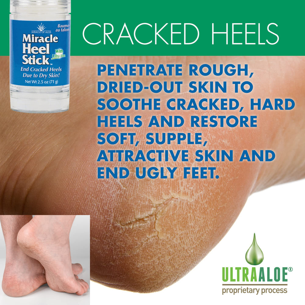 Miracle of Aloe Heel Stick, botella compacta para uso diario.