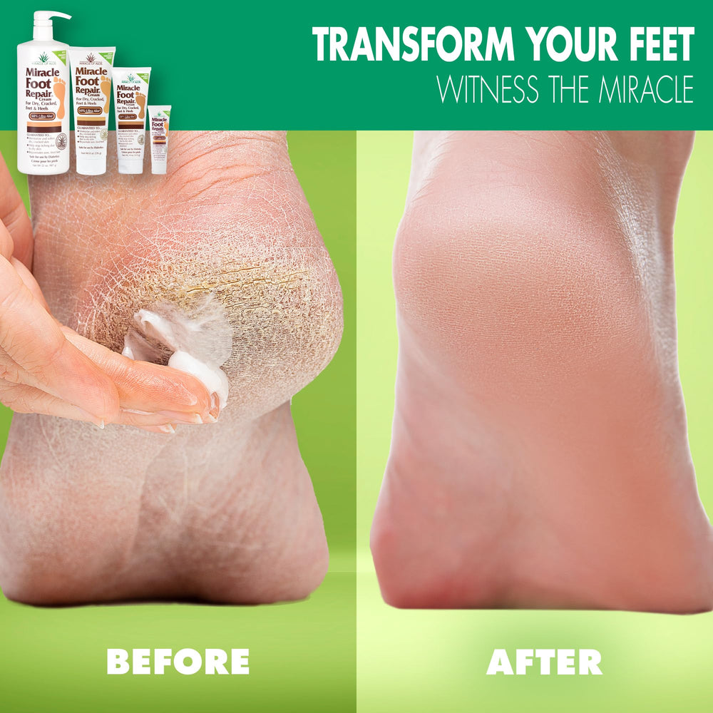 La textura cremosa de Miracle of Aloe en la mano, para demostrar absorción rápida.