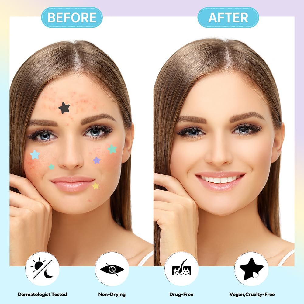 Parche estrella de 12 mm MISMALS para brotes medianos y cubriendo la imperfección.