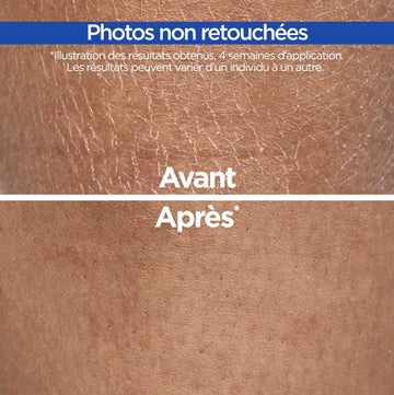 Mixa Crème Cica Réparation – zones sèches lissées dès les premières applications.