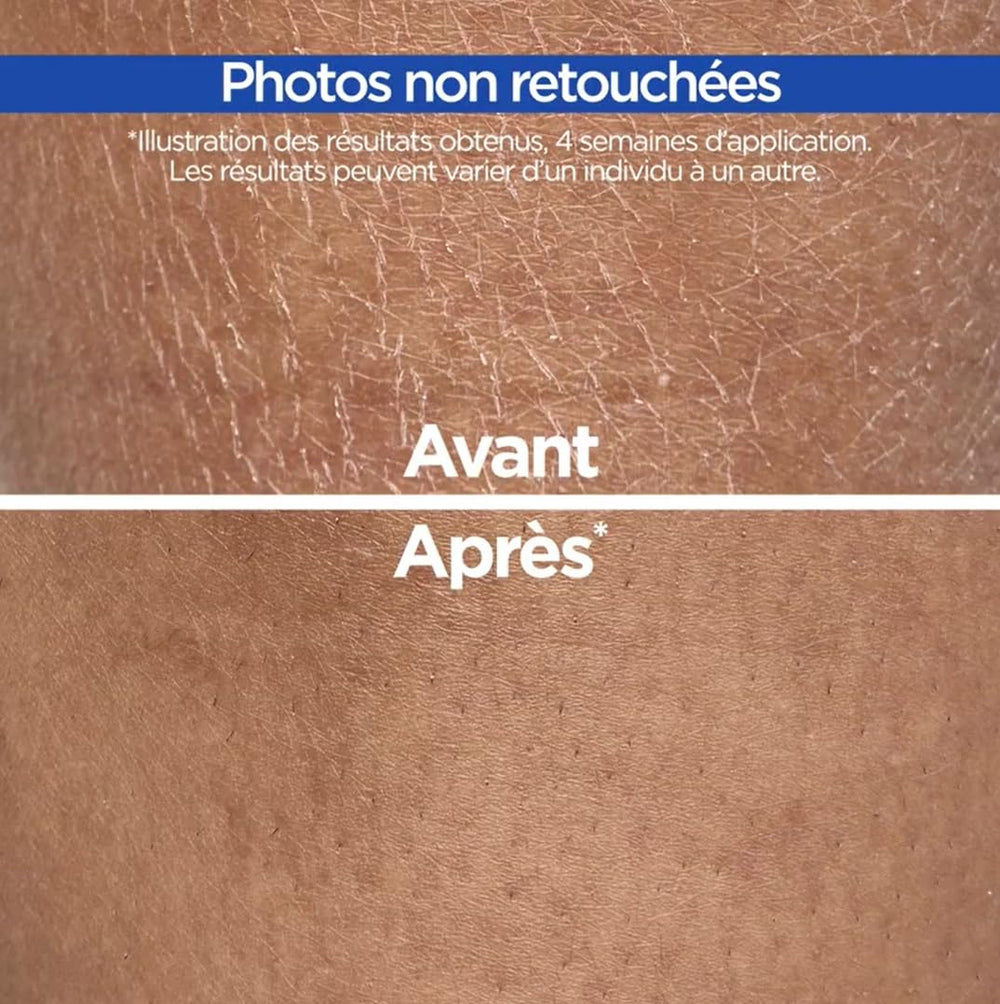 Mixa Crème Cica Réparation – zones sèches lissées dès les premières applications.