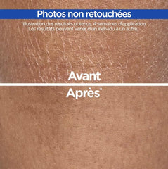 Mixa Crème Cica Réparation – zones sèches lissées dès les premières applications.