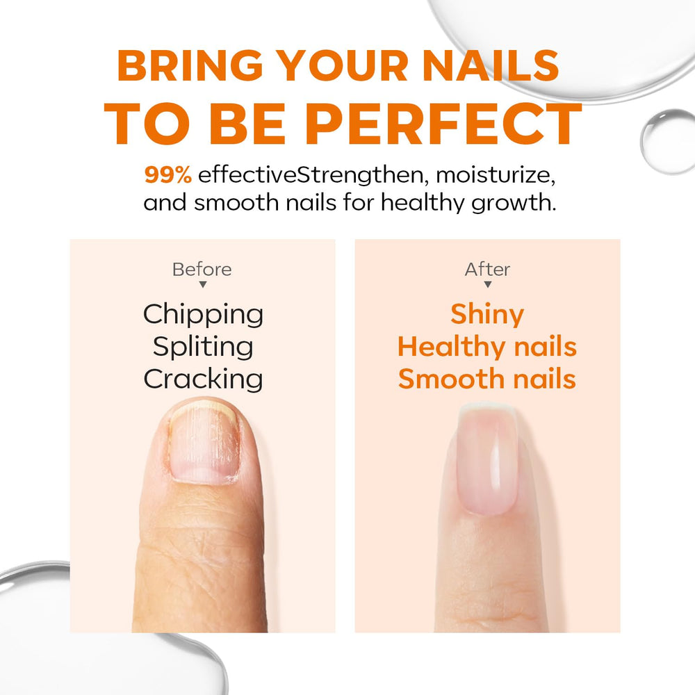 Modelones-uñas-dañadas-reparacion: muestra reparación suave para uñas dañadas.